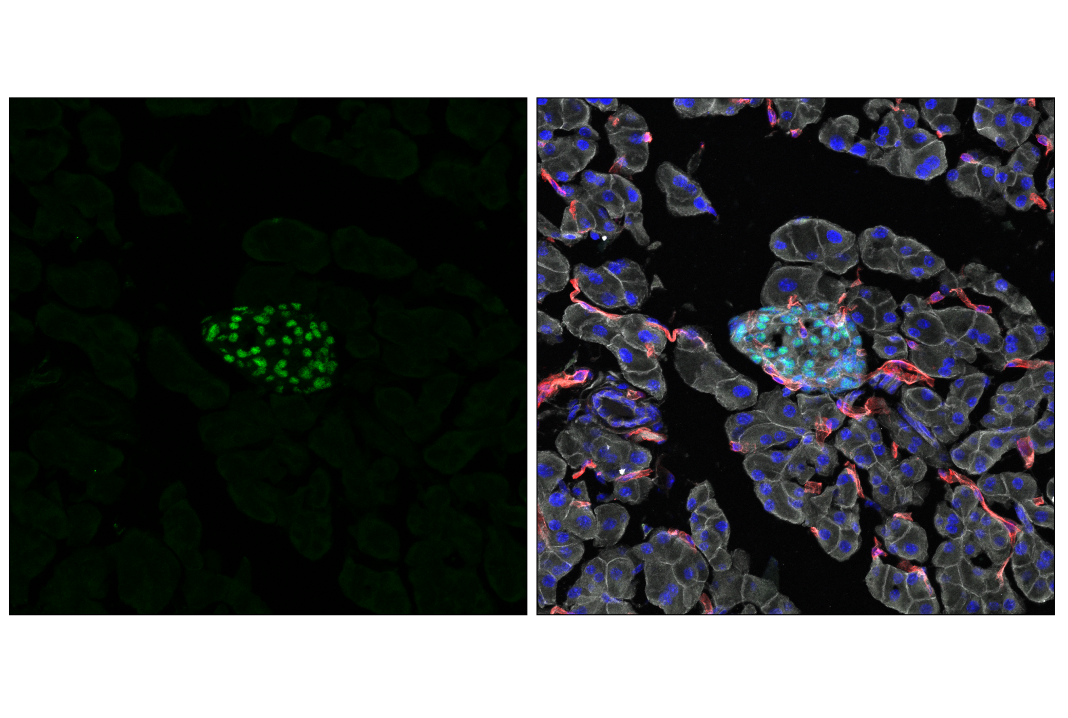 Immunofluorescence Image 1: NeuroD1 (E3E4F) Rabbit mAb