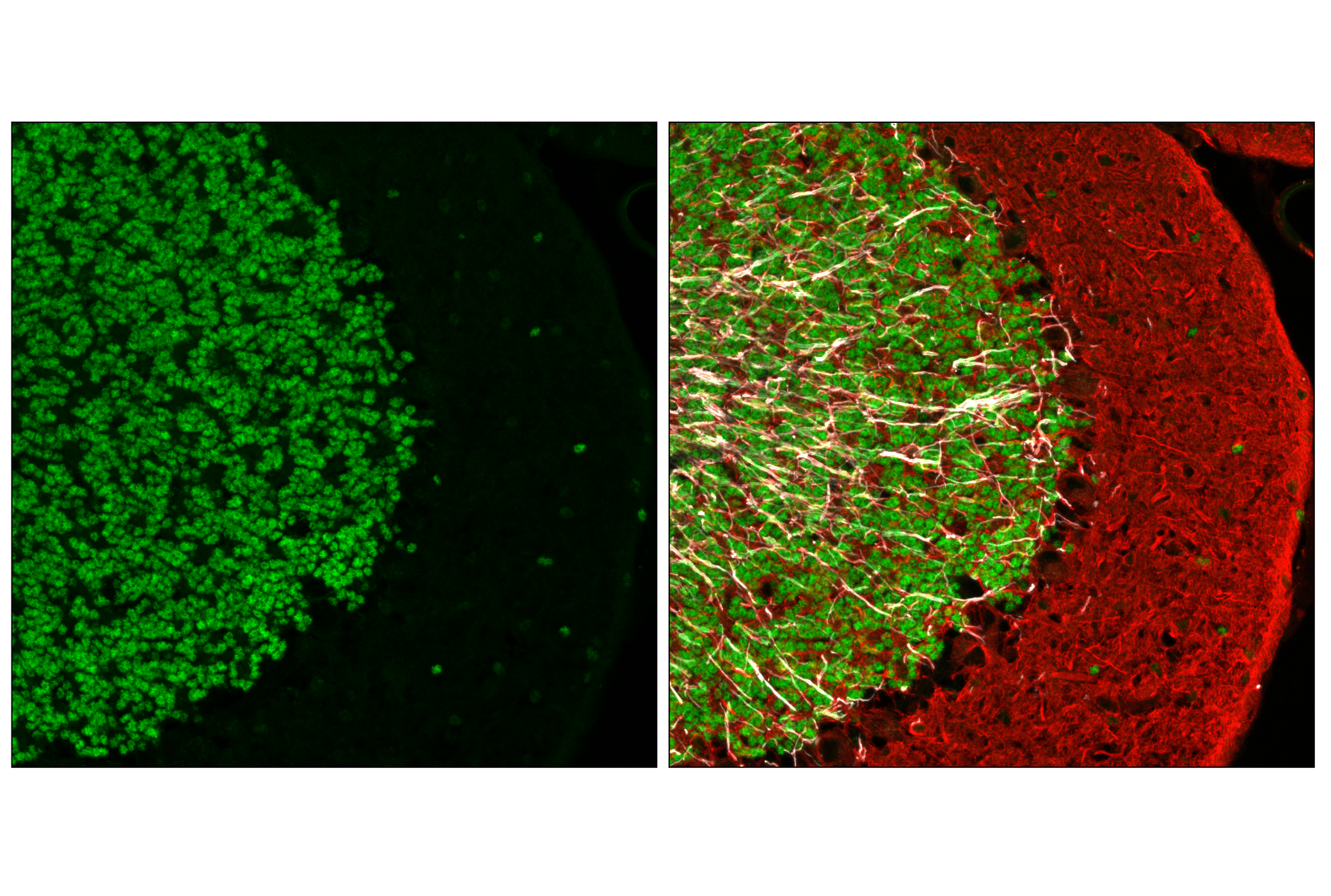 Immunofluorescence Image 3: NeuroD1 (E3E4F) Rabbit mAb