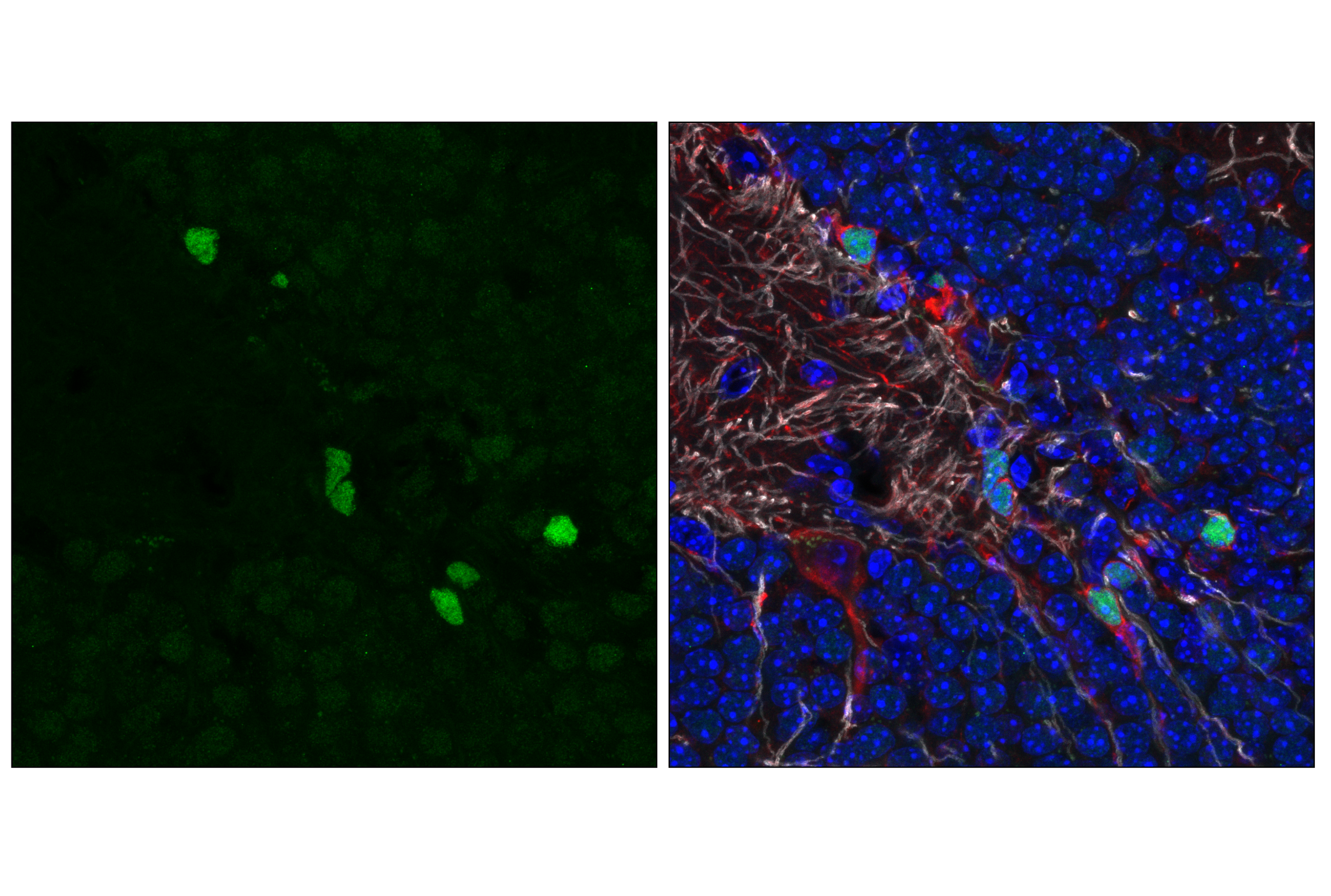 Immunofluorescence Image 4: NeuroD1 (E3E4F) Rabbit mAb