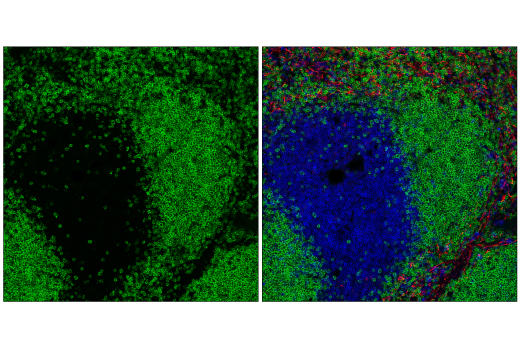 Immunofluorescence Image 1: CD20 (E3N7O) XP® Rabbit mAb (Alexa Fluor® 488 Conjugate)