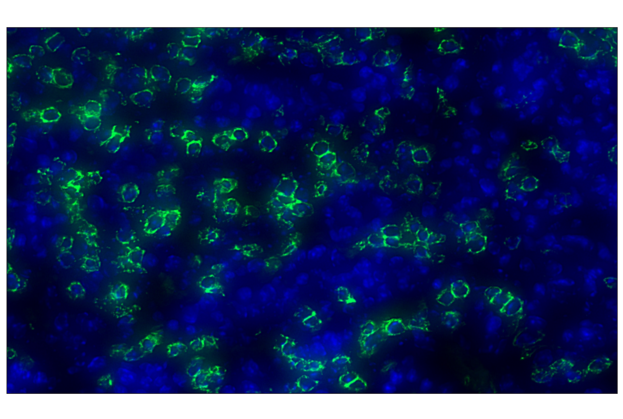 Immunohistochemistry Image 1: CD20 (E3N7O) XP® Rabbit mAb (Alexa Fluor® 488 Conjugate)