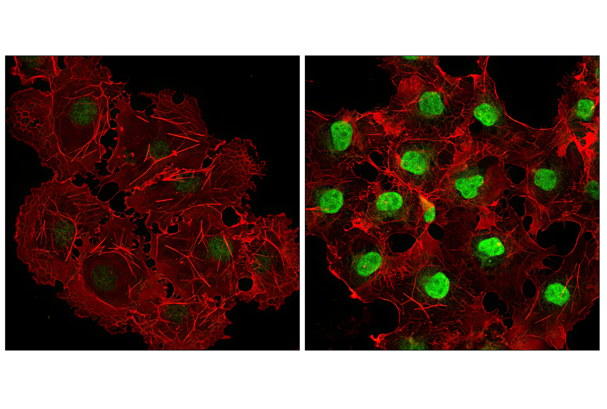 Immunofluorescence Image 1: Phospho-p38 MAPK (Thr180/Tyr182) (D3F9) XP® Rabbit mAb (BSA and Azide Free)