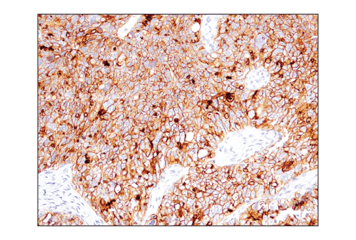 Immunohistochemistry Image 2: CD47 (D3O7P) Rabbit mAb