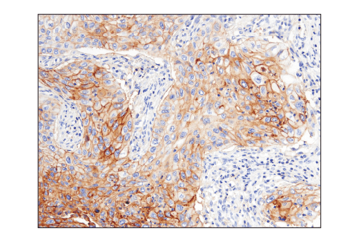 Immunohistochemistry Image 6: CD47 (D3O7P) Rabbit mAb