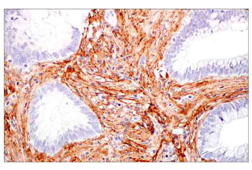 Immunohistochemistry Image 6: COL3A1 (E8D7R) XP® Rabbit mAb