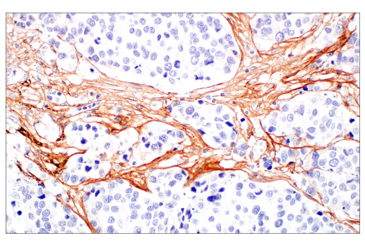 Immunohistochemistry Image 4: COL3A1 (E8D7R) XP® Rabbit mAb