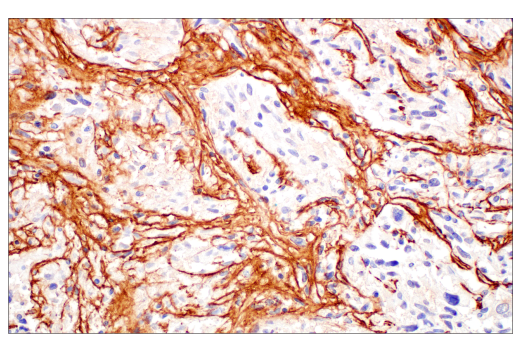Immunohistochemistry Image 3: COL3A1 (E8D7R) XP® Rabbit mAb