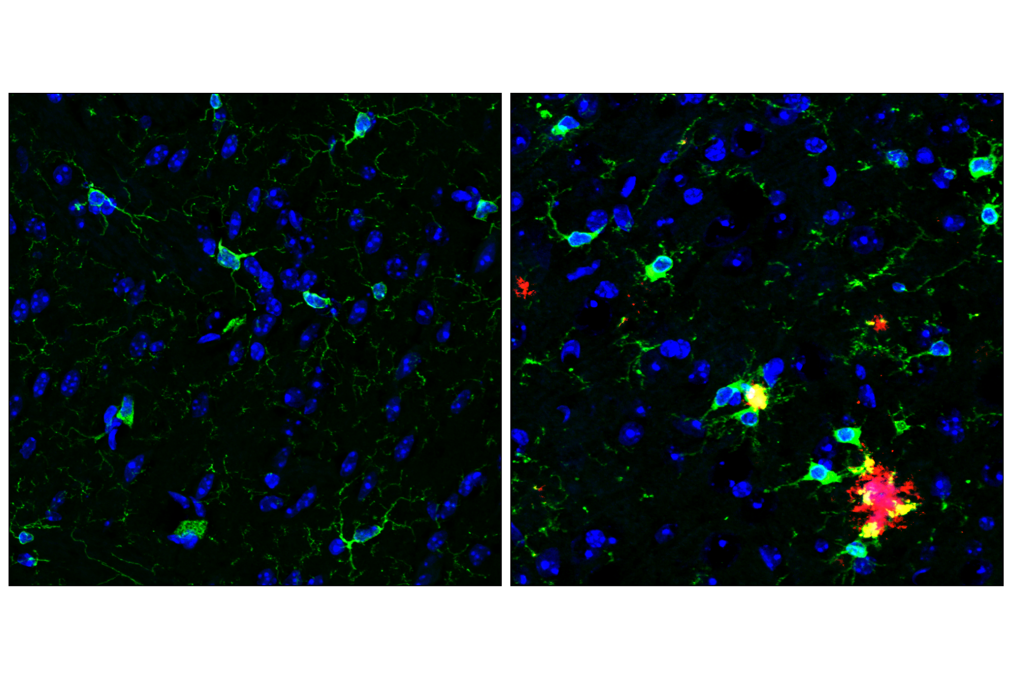 Immunofluorescence Image 1: HS1 (D5A9) XP® Rabbit mAb (BSA and Azide Free)