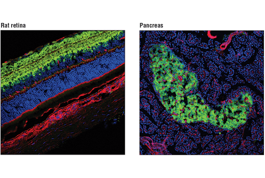 Immunofluorescence Image 2: GAD1 (A9A5X) Rabbit mAb