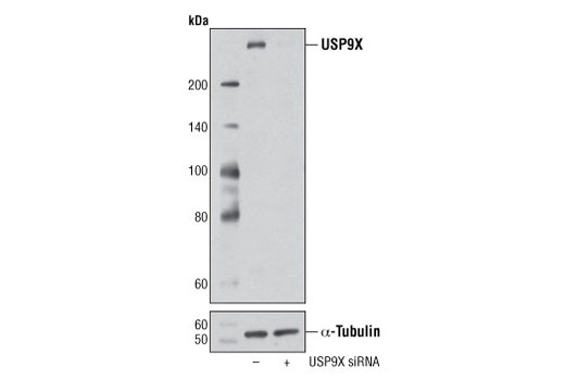  Image 1: SignalSilence® USP9X siRNA I