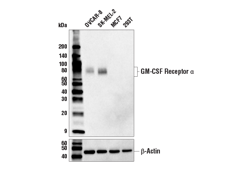 Western Blotting Image 1: GM-CSF Receptor α (E8Z3S) Rabbit mAb (BSA and Azide Free)