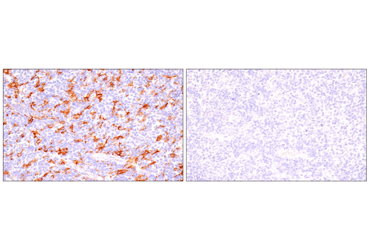 Immunohistochemistry Image 10: GM-CSF Receptor α (E8Z3S) Rabbit mAb (BSA and Azide Free)
