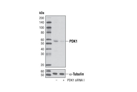  Image 1: SignalSilence® PDK1 siRNA I