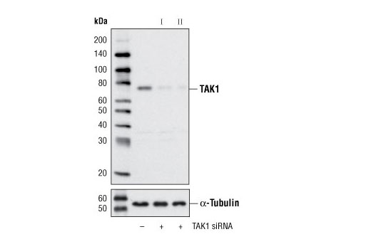  Image 1: SignalSilence® TAK1 siRNA I