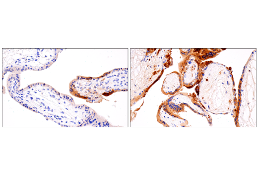 Immunohistochemistry Image 2: PAI-1 (E3I5H) XP® Rabbit mAb (BSA and Azide Free)