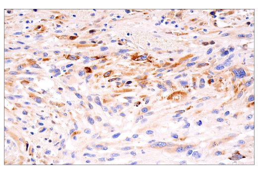 Immunohistochemistry Image 6: PAI-1 (E3I5H) XP® Rabbit mAb (BSA and Azide Free)