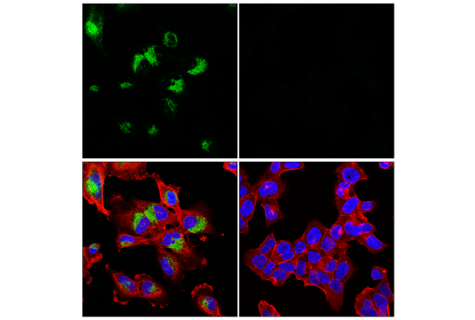 Immunofluorescence Image 1: PAI-1 (E3I5H) XP® Rabbit mAb (BSA and Azide Free)
