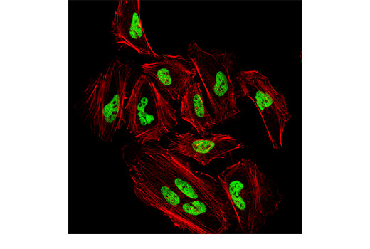 Immunofluorescence Image 1: YY1 (D3D4Q) Rabbit mAb