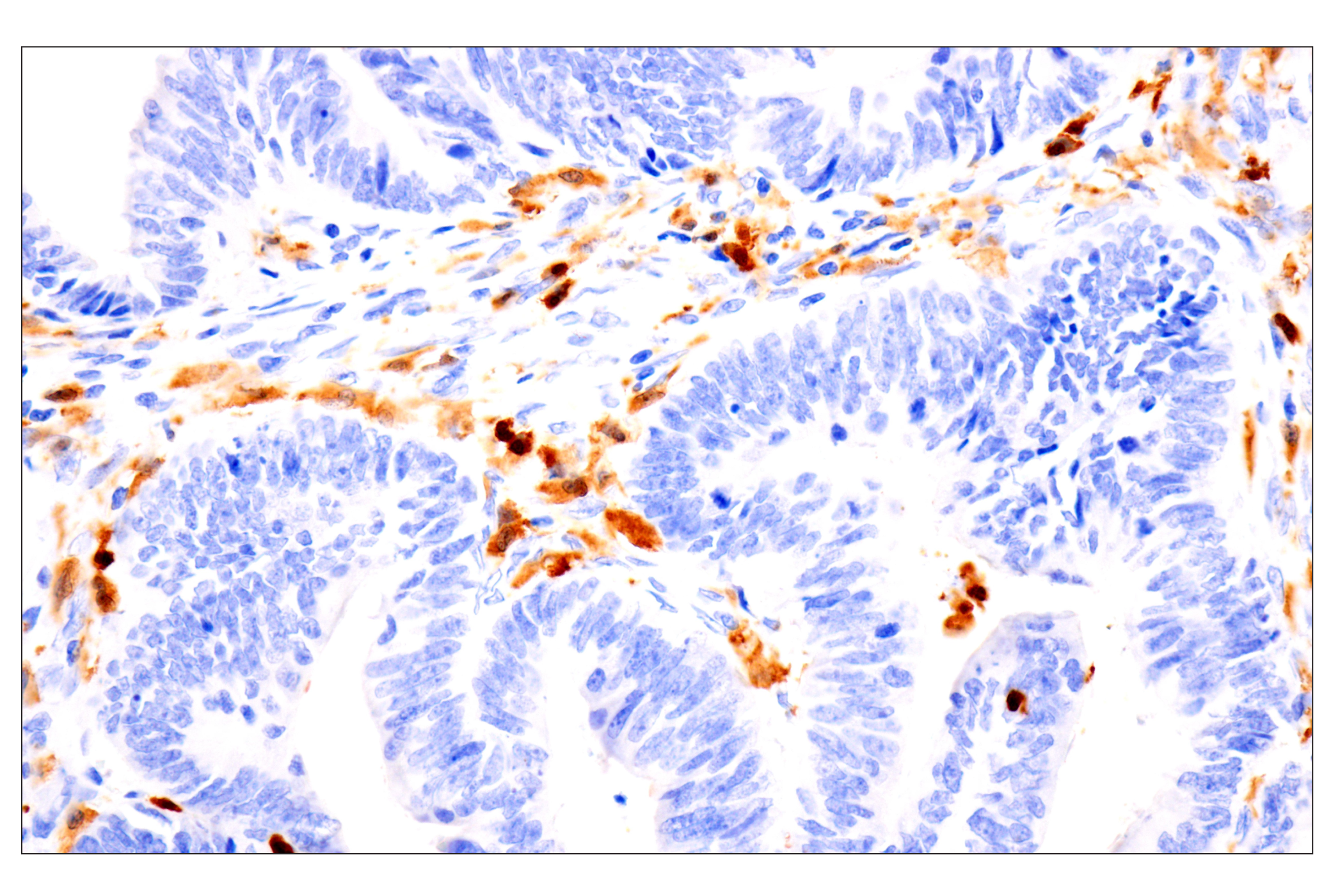 Immunohistochemistry Image 1: p47phox (F3Y6C) Rabbit mAb