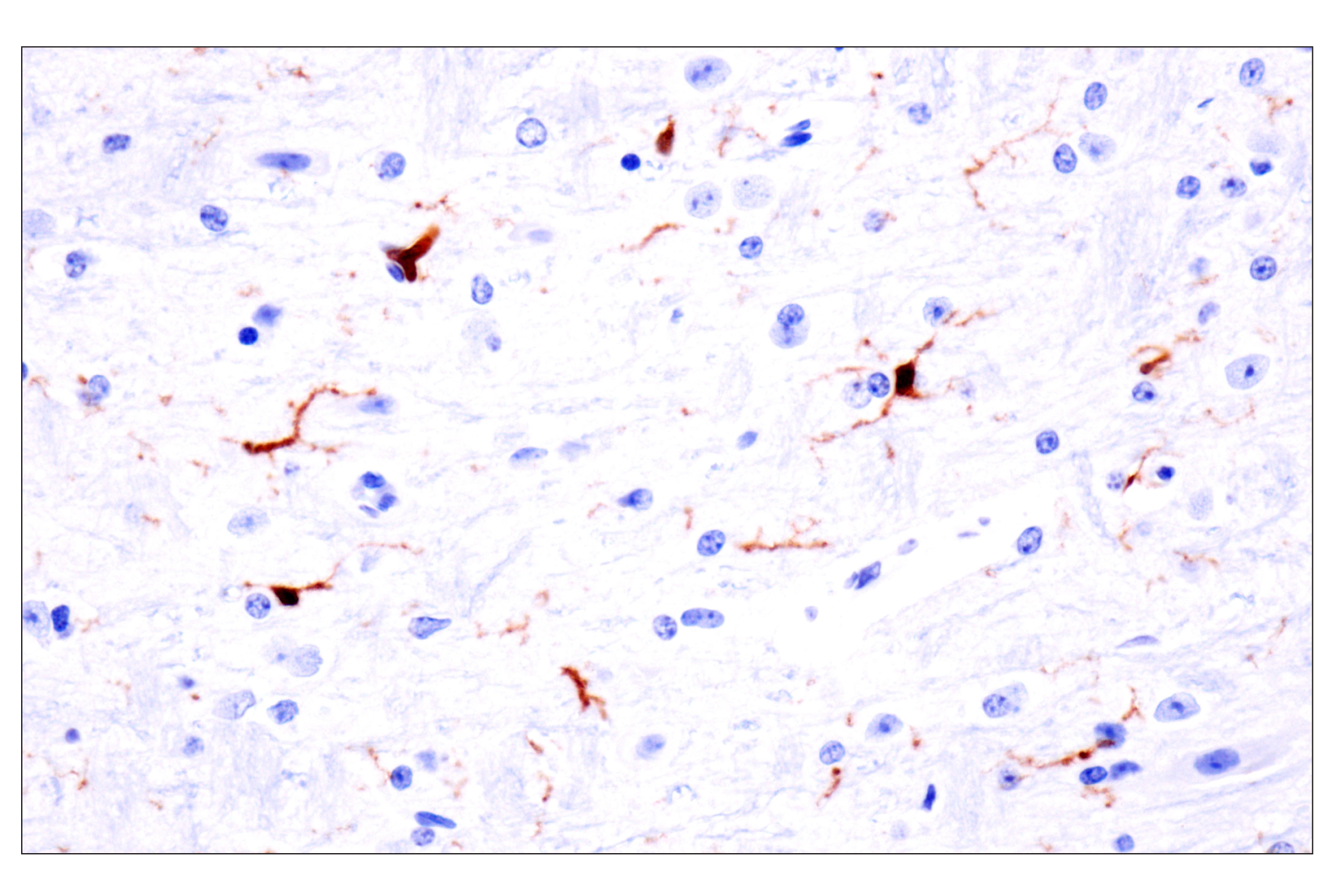 Immunohistochemistry Image 9: p47phox (F3Y6C) Rabbit mAb