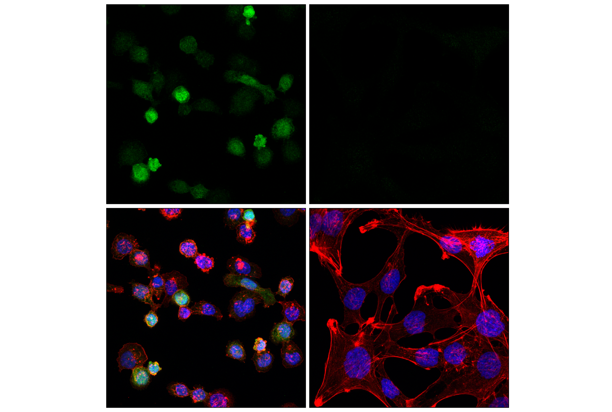 Immunofluorescence Image 1: p47phox (F3Y6C) Rabbit mAb