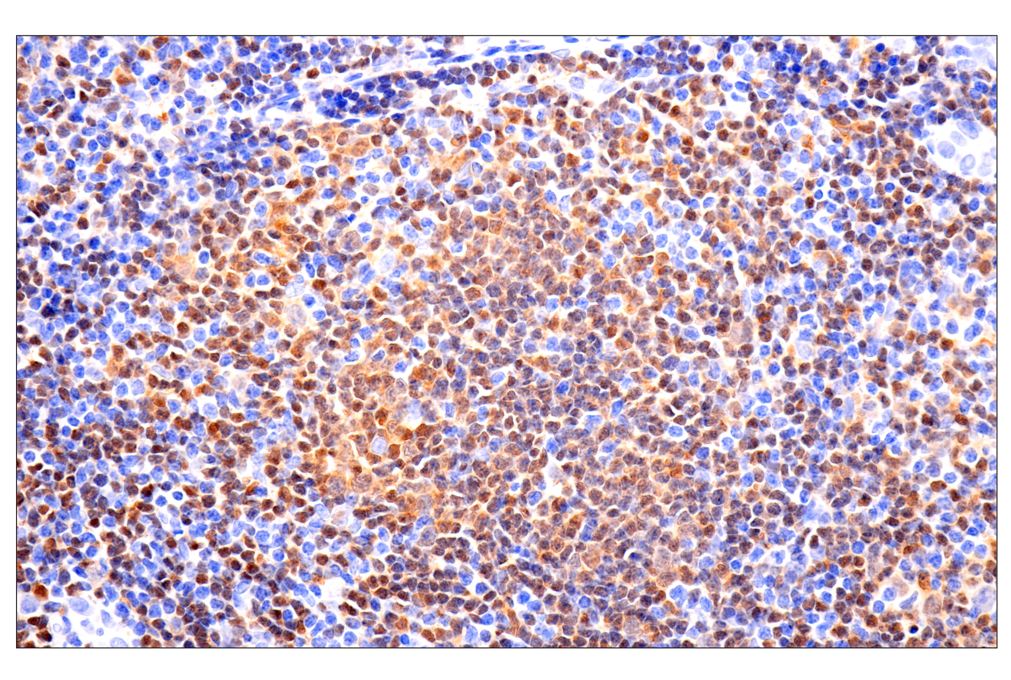 Immunohistochemistry Image 2: p47phox (F3Y6C) Rabbit mAb