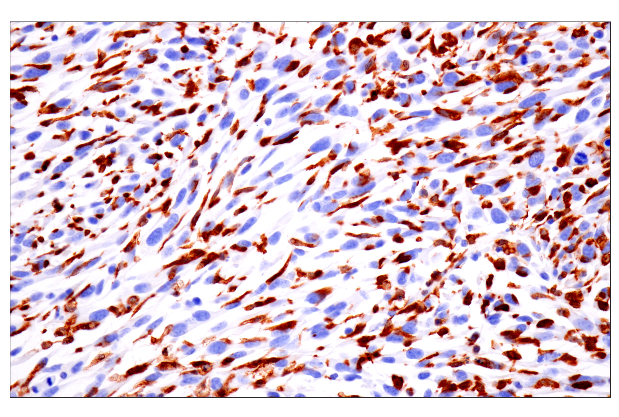 Immunohistochemistry Image 7: p47phox (F3Y6C) Rabbit mAb