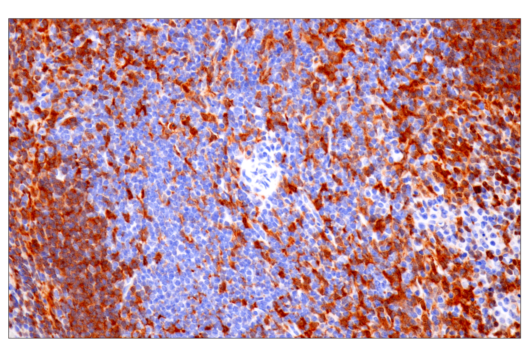 Immunohistochemistry Image 8: p47phox (F3Y6C) Rabbit mAb