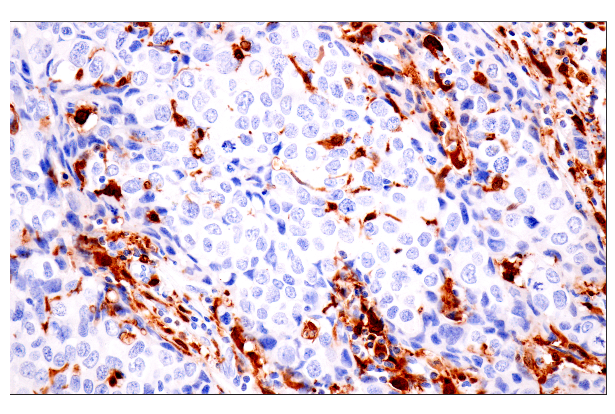 Immunohistochemistry Image 3: p47phox (F3Y6C) Rabbit mAb