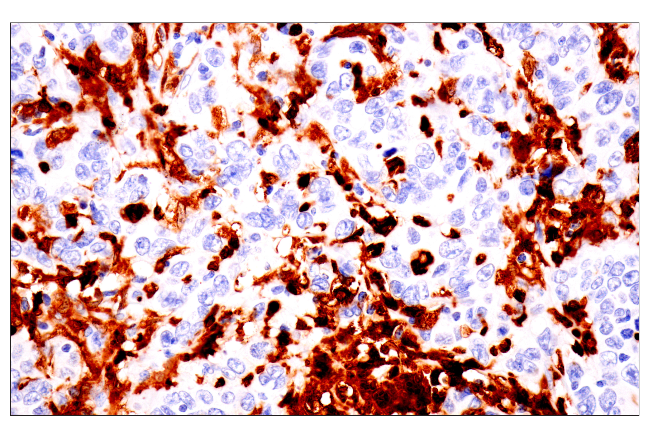 Immunohistochemistry Image 4: p47phox (F3Y6C) Rabbit mAb