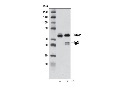 Immunoprecipitation Image 1: Chk2 (D9C6) Rabbit mAb