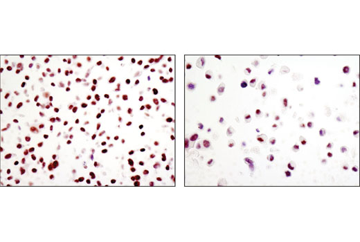  Image 28: Phospho-Chk1/2 Antibody Sampler Kit