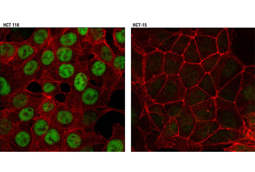 Immunofluorescence Image 1: Chk2 (D9C6) XP® Rabbit mAb