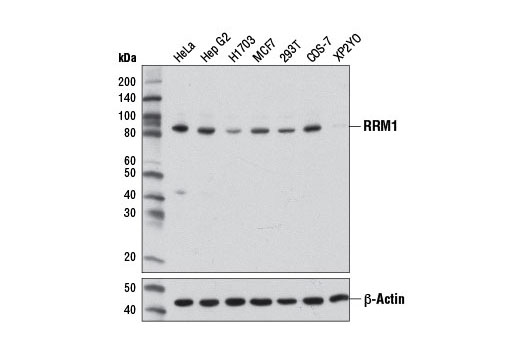 Western Blotting Image 1: RRM1 (D12F12) XP® Rabbit mAb (BSA and Azide Free)