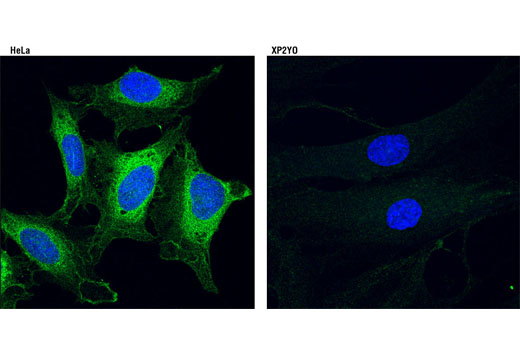 Immunofluorescence Image 1: RRM1 (D12F12) XP® Rabbit mAb (BSA and Azide Free)