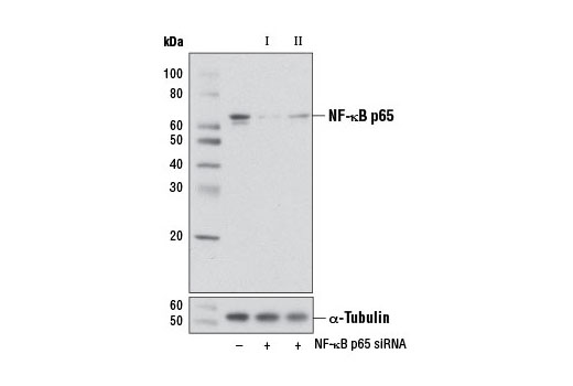  Image 1: SignalSilence® NF-κB p65 siRNA I (Mouse Specific)