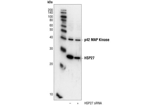  Image 2: SignalSilence® HSP27 siRNA I