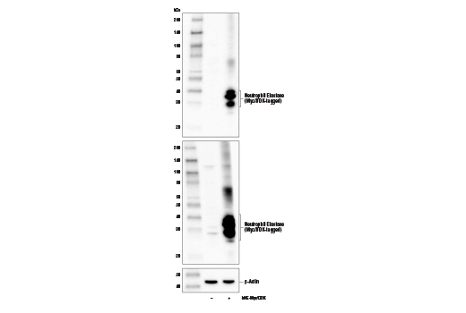 Western Blotting Image 2: Neutrophil Elastase Antibody