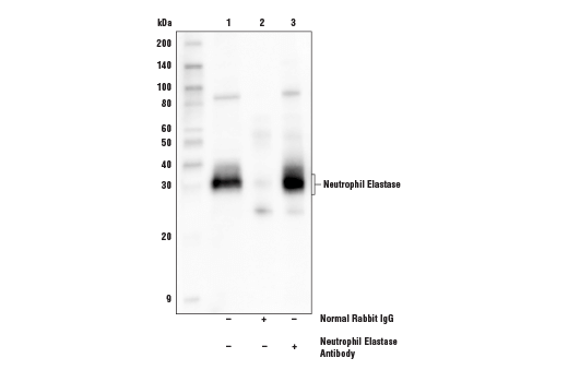 Immunoprecipitation Image 1: Neutrophil Elastase Antibody
