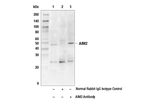 Immunoprecipitation Image 1: AIM2 Antibody