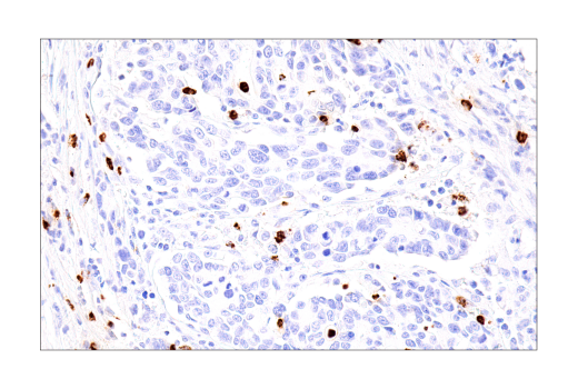 Immunohistochemistry Image 1: Cathepsin G (E3N3O) Rabbit mAb