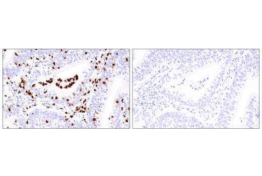 Immunohistochemistry Image 2: Cathepsin G (E3N3O) Rabbit mAb