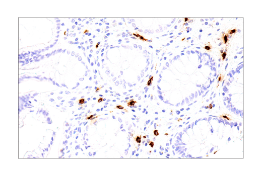 Immunohistochemistry Image 4: Cathepsin G (E3N3O) Rabbit mAb