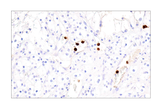 Immunohistochemistry Image 5: Cathepsin G (E3N3O) Rabbit mAb