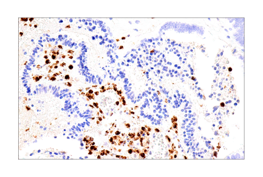 Immunohistochemistry Image 8: Cathepsin G (E3N3O) Rabbit mAb