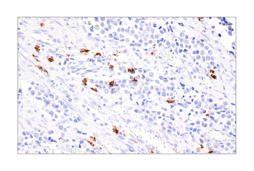 Immunohistochemistry Image 11: Cathepsin G (E3N3O) Rabbit mAb
