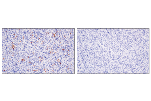 Immunohistochemistry Image 6: XCR1 (D2F8T) Rabbit mAb (BSA and Azide Free)