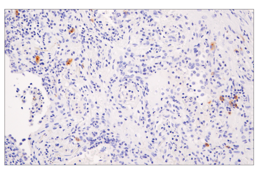 Immunohistochemistry Image 3: XCR1 (D2F8T) Rabbit mAb (BSA and Azide Free)