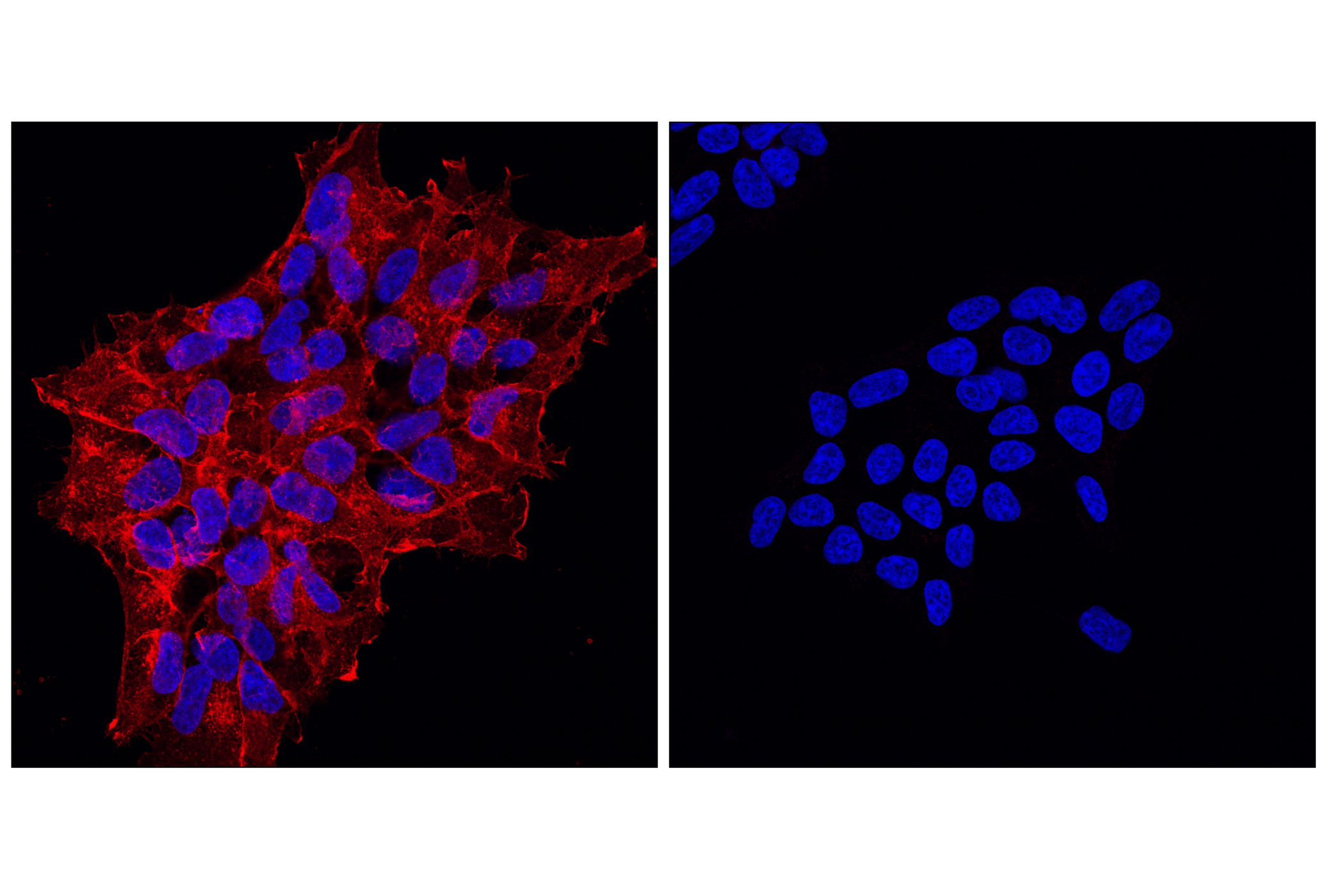 Immunofluorescence Image 1: Myc-Tag (71D10) Rabbit mAb (Alexa Fluor® 647 Conjugate)