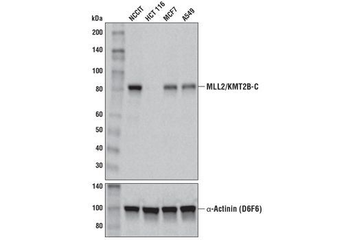 Western Blotting Image 1: MLL2/KMT2B (D6X2E) Rabbit mAb (Carboxy-terminal Antigen)